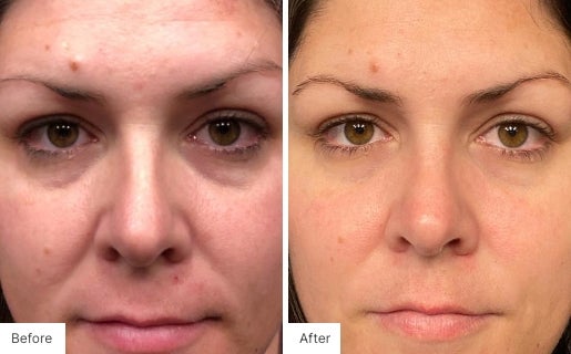 8 - Before and After Real Results photo of a woman's face.