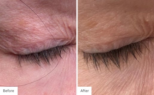 Close-up image of eyelashes showing fuller and longer lashes after 16 weeks of Lash Lush use